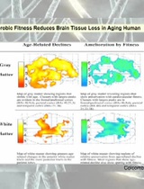 Exercise and Brain Function